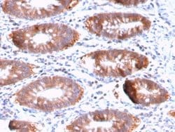 Aurora B Antibody (AURKB/3121R) - Azide and BSA Free, Novus Biologicals 100 &mu;g | Buy Online | Novus Biologicals | Fisher Scientific